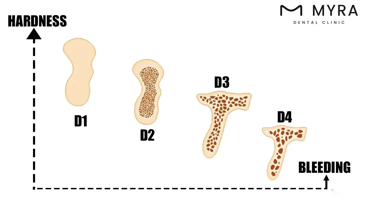 does bone quality.webp